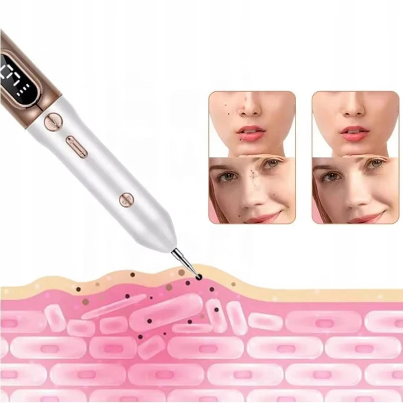 Plasma Pen do Usuwania Znamion, Pieprzyków i Włókniaków