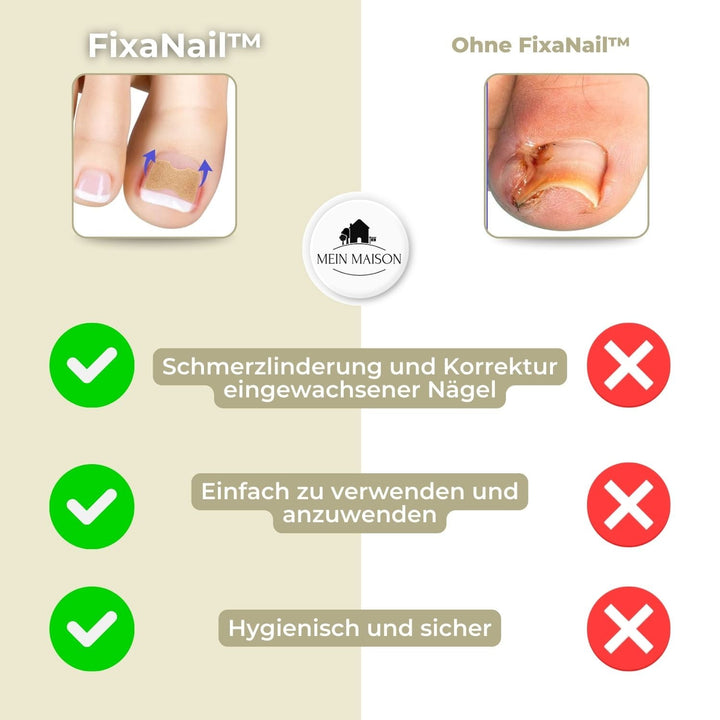 Carvallo | FixaNail - Natychmiastowa naprawa paznokci