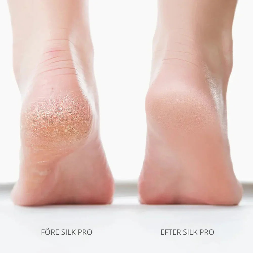 Bliss Silk Pro 2 – Miękkie stopy bez drogich wizyt w salonie