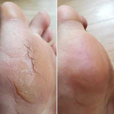 Bliss Silk Pro 2 – Miękkie stopy bez drogich wizyt w salonie